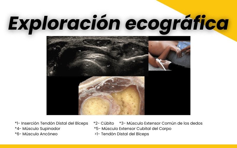 4. Ecografia tendon distal biceps tempo formacion.png